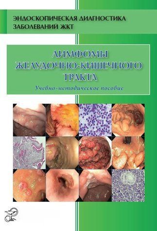 Книга "Лімфоми шлунково-кишкового тракту" &ndash; Кузін М. DGN07990 фото